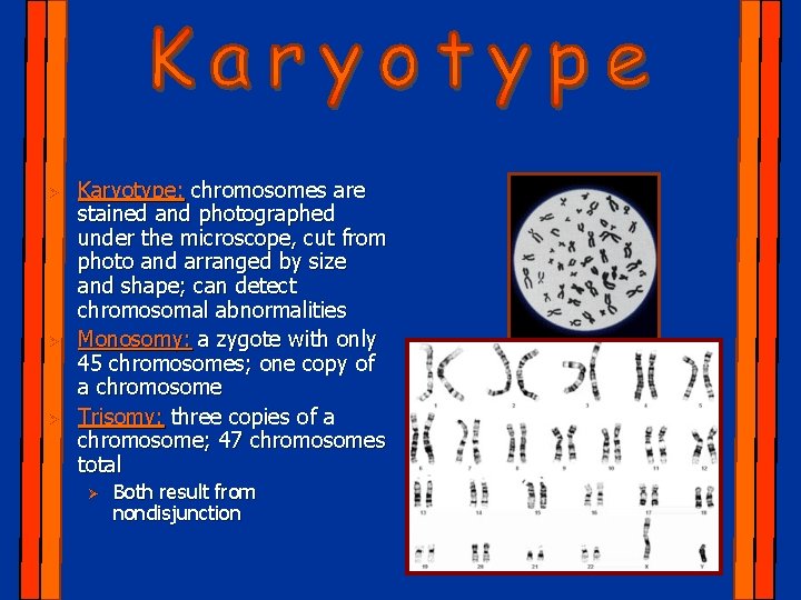 Ø Ø Ø Karyotype: chromosomes are stained and photographed under the microscope, cut from