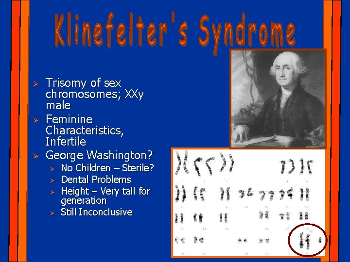 Ø Ø Ø Trisomy of sex chromosomes; XXy male Feminine Characteristics, Infertile George Washington?