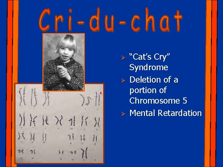Ø Ø Ø “Cat’s Cry” Syndrome Deletion of a portion of Chromosome 5 Mental
