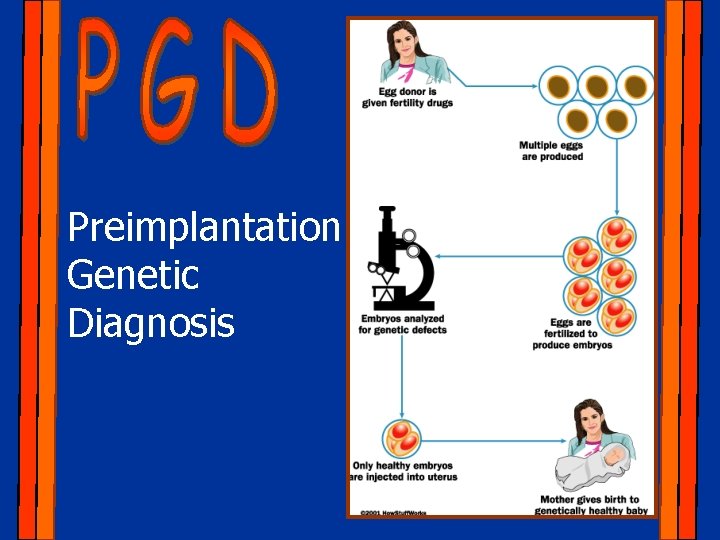 Preimplantation Genetic Diagnosis 