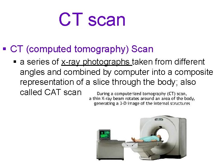 CT scan § CT (computed tomography) Scan § a series of x-ray photographs taken