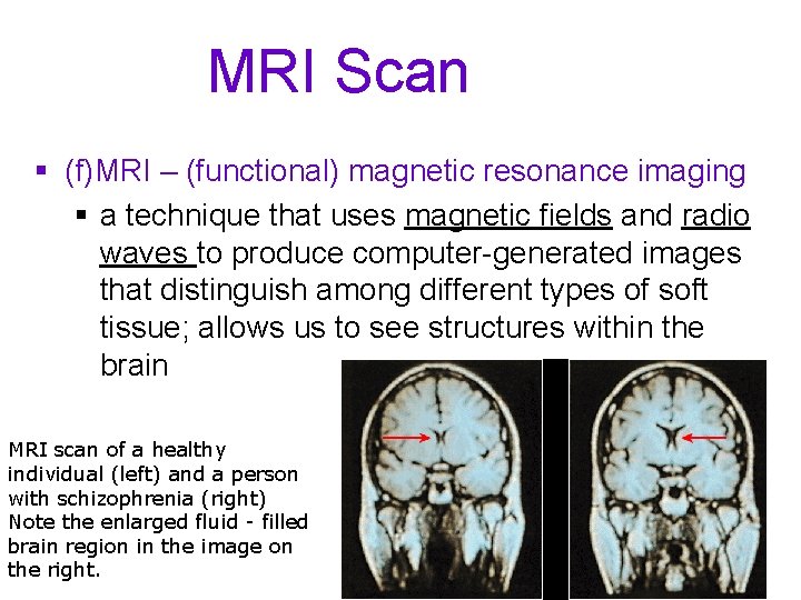 MRI Scan § (f)MRI – (functional) magnetic resonance imaging § a technique that uses