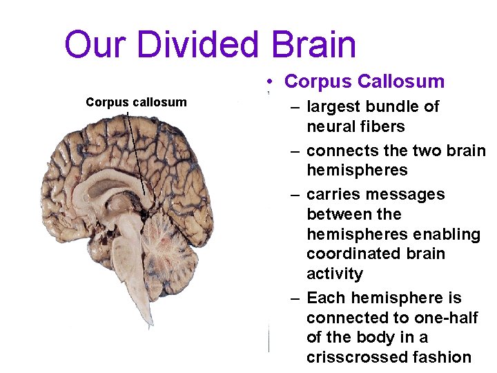 Our Divided Brain • Corpus Callosum Corpus callosum – largest bundle of neural fibers