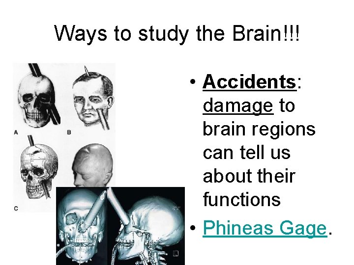 Ways to study the Brain!!! • Accidents: damage to brain regions can tell us