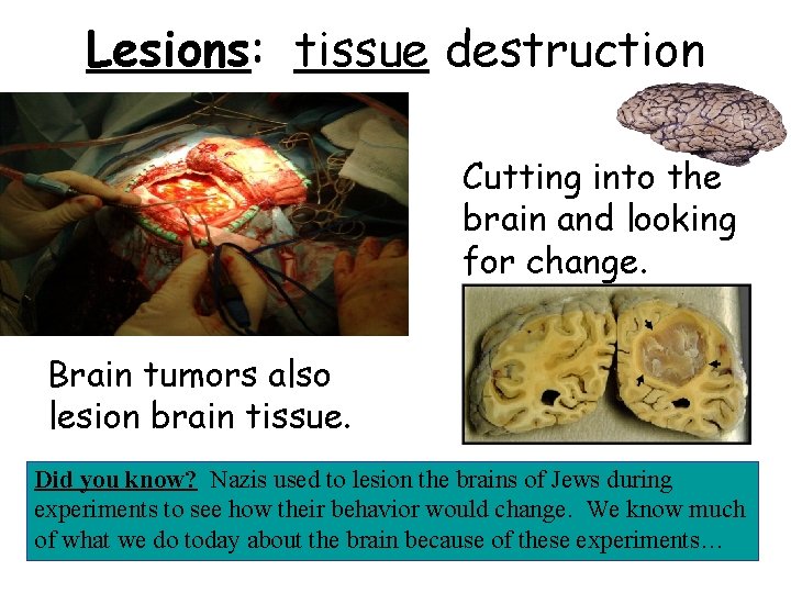 Lesions: tissue destruction Cutting into the brain and looking for change. Brain tumors also