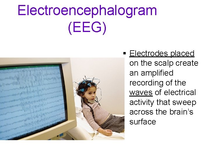 Electroencephalogram (EEG) § Electrodes placed on the scalp create an amplified recording of the