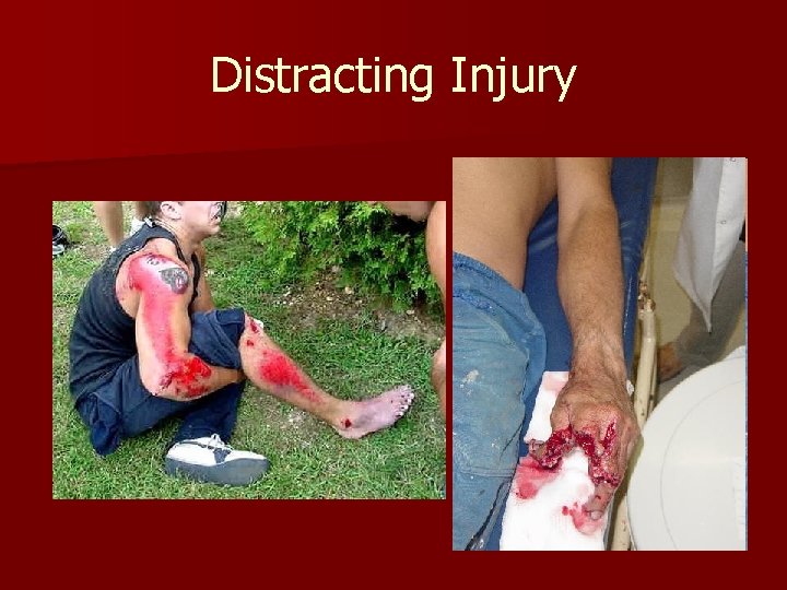 Distracting Injury 