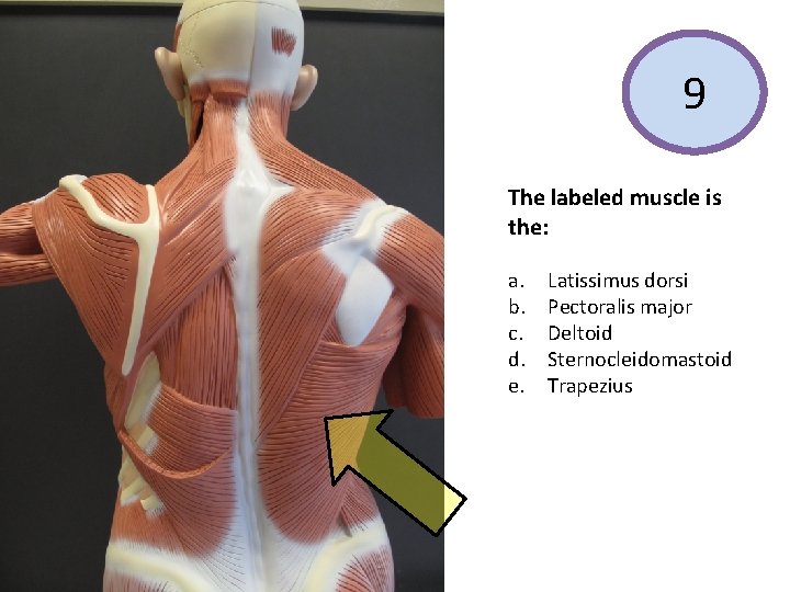 9 The labeled muscle is the: a. b. c. d. e. Latissimus dorsi Pectoralis