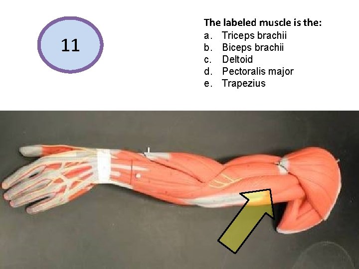 The labeled muscle is the: 11 a. b. c. d. e. Triceps brachii Biceps
