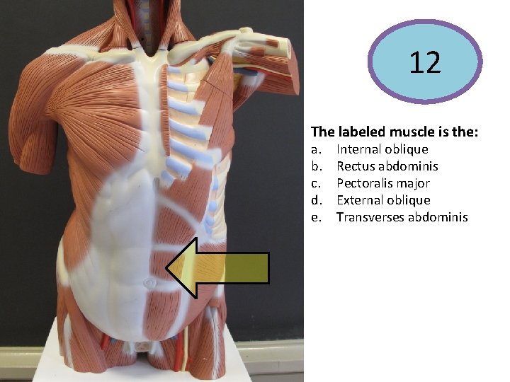 12 The labeled muscle is the: a. b. c. d. e. Internal oblique Rectus