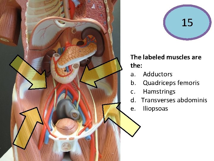 15 The labeled muscles are the: a. Adductors b. Quadriceps femoris c. Hamstrings d.