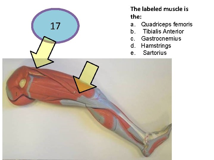 17 The labeled muscle is the: a. Quadriceps femoris b. Tibialis Anterior c. Gastrocnemius