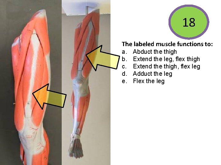 18 The labeled muscle functions to: • Extend the thigh • Flex the hip