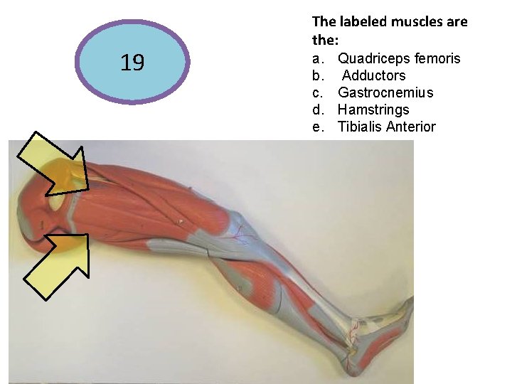 19 The labeled muscles are the: a. b. c. d. e. Quadriceps femoris Adductors