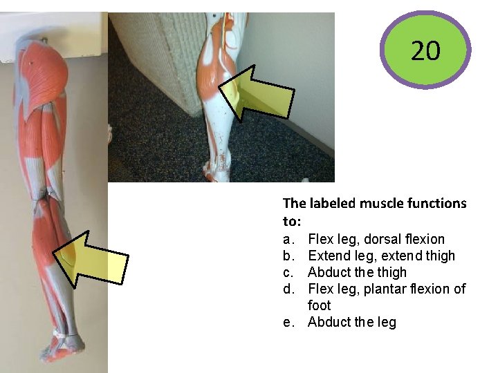 20 The labeled muscle functions to: a. b. c. d. Flex leg, dorsal flexion