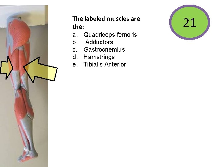 The labeled muscles are the: a. b. c. d. e. Quadriceps femoris Adductors Gastrocnemius