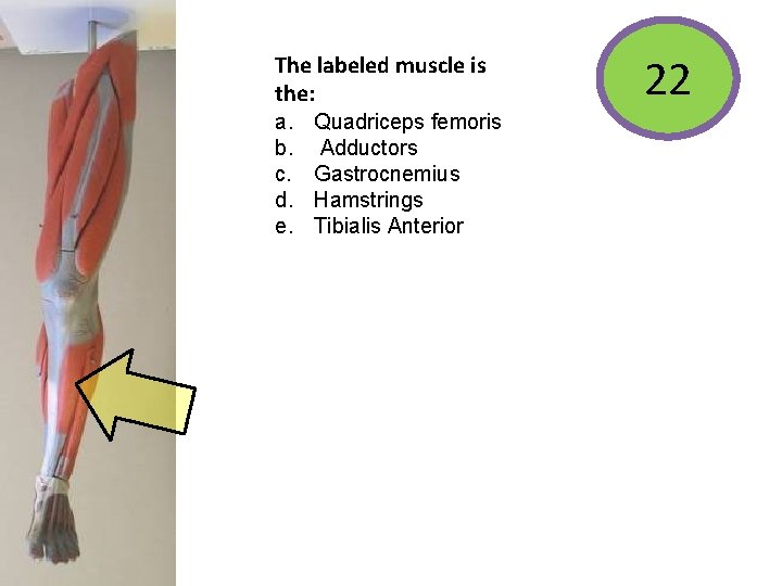 The labeled muscle is the: a. b. c. d. e. Quadriceps femoris Adductors Gastrocnemius