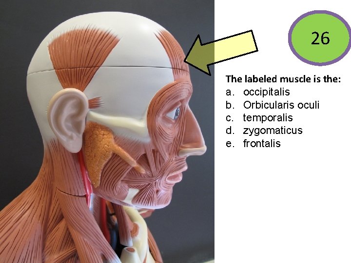 26 The labeled muscle is the: a. occipitalis b. Orbicularis oculi c. temporalis d.