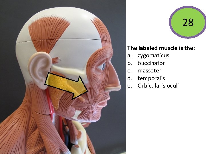 28 The labeled muscle is the: a. zygomaticus b. buccinator c. masseter d. temporalis