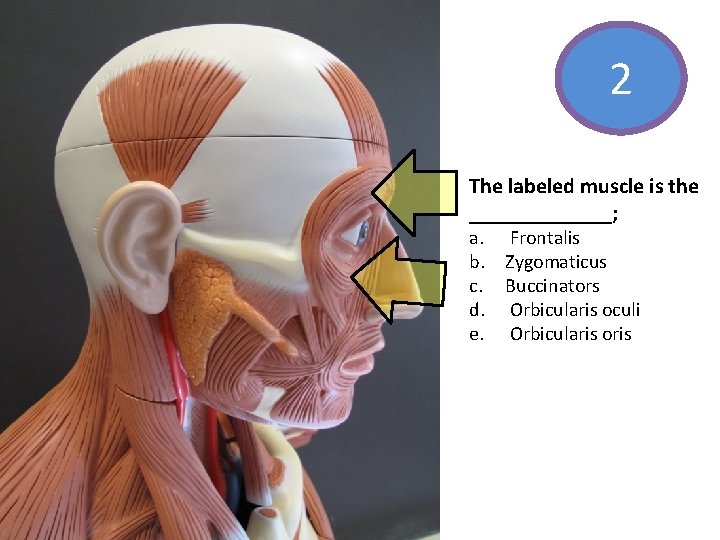 2 The labeled muscle is the _______; a. Frontalis b. Zygomaticus c. Buccinators d.