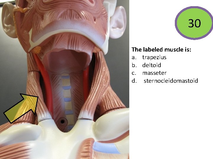 30 The labeled muscle is: a. trapezius b. deltoid c. masseter d. sternocleidomastoid 