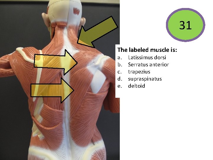 31 The labeled muscle is: a. b. c. d. e. Latissimus dorsi Serratus anterior