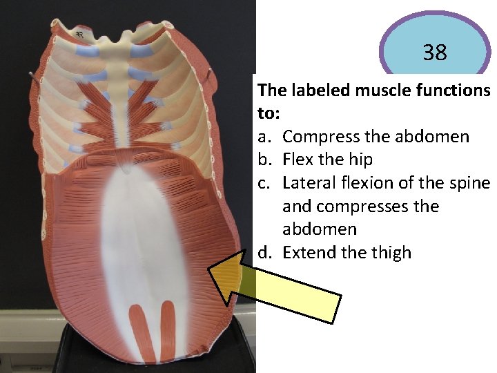 38 The labeled muscle functions to: a. Compress the abdomen b. Flex the hip