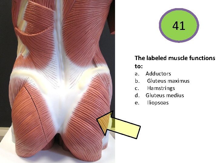 41 The labeled muscle functions to: a. Adductors b. Gluteus maximus c. Hamstrings d.