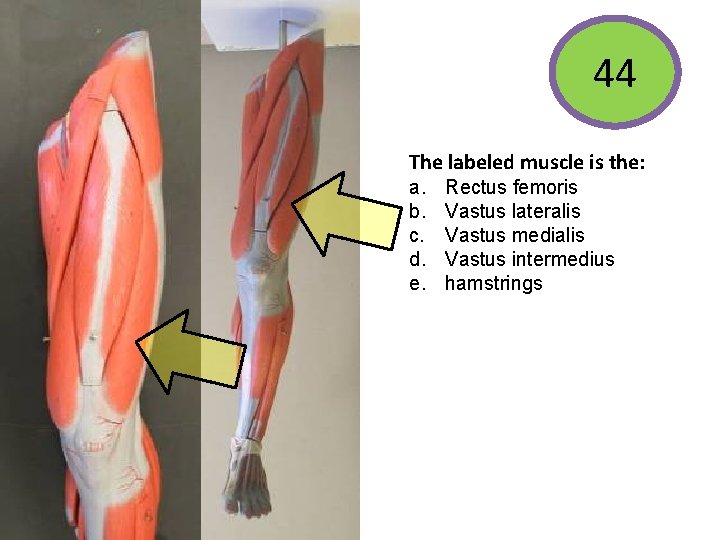 44 The labeled muscle is the: The labeled muscle functions to: • Extend the