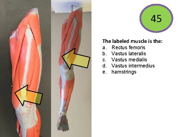 45 The labeled muscle is the: The labeled muscle functions to: • Extend the