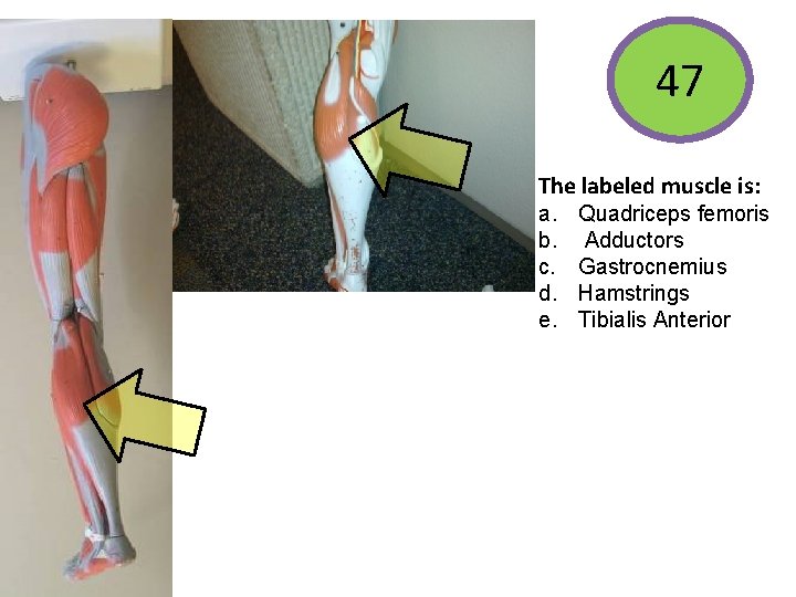 47 The labeled muscle is: a. b. c. d. e. Quadriceps femoris Adductors Gastrocnemius