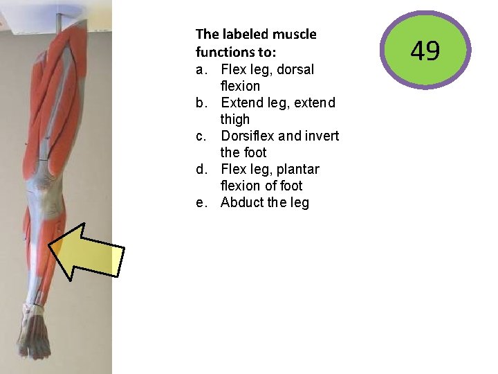 The labeled muscle functions to: a. Flex leg, dorsal flexion b. Extend leg, extend