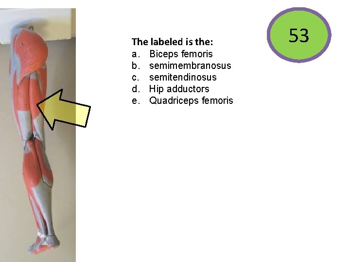 The labeled is the: a. b. c. d. e. Biceps femoris semimembranosus semitendinosus Hip