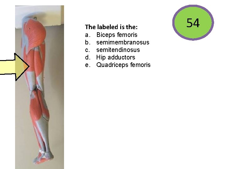 The labeled is the: a. b. c. d. e. Biceps femoris semimembranosus semitendinosus Hip
