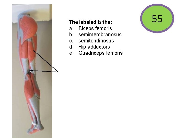 The labeled is the: a. b. c. d. e. Biceps femoris semimembranosus semitendinosus Hip