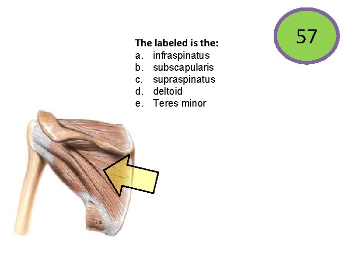 The labeled is the: a. b. c. d. e. infraspinatus subscapularis supraspinatus deltoid Teres