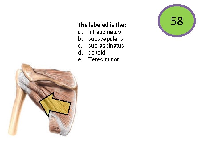 The labeled is the: a. b. c. d. e. infraspinatus subscapularis supraspinatus deltoid Teres