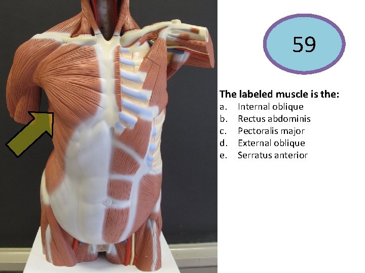 59 The labeled muscle is the: a. b. c. d. e. Internal oblique Rectus