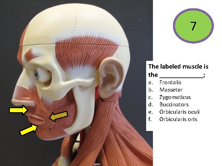 7 The labeled muscle is the _______; a. b. c. d. e. f. Frontalis