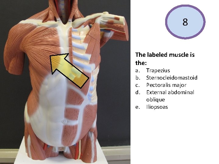 8 The labeled muscle is the: a. b. c. d. e. Trapezius Sternocleidomastoid Pectoralis