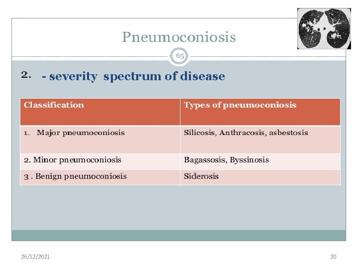- severity spectrum of disease 26/12/2021 20 