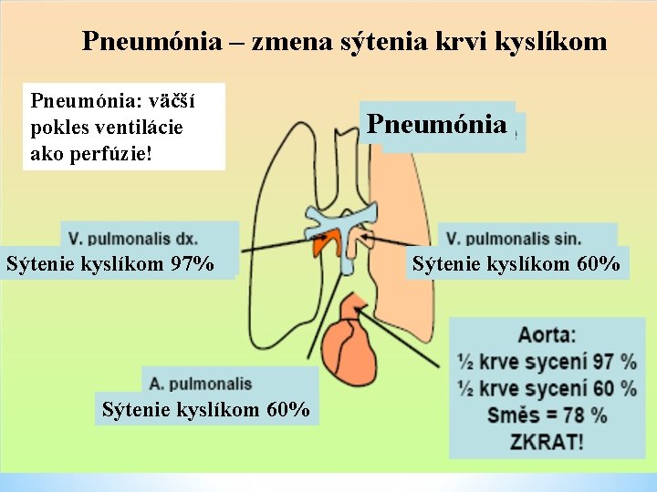 Pneumónia – zmena sýtenia krvi kyslíkom Pneumónia: väčší pokles ventilácie ako perfúzie! Sýtenie kyslíkom