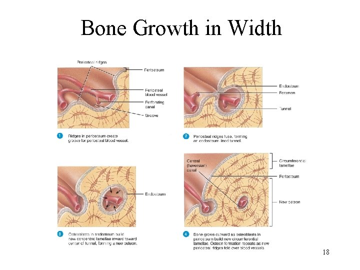 Bone Growth in Width 18 