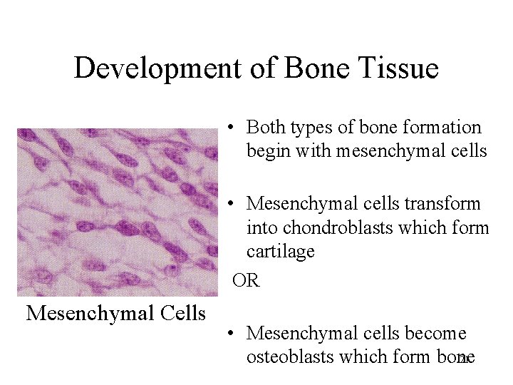 Development of Bone Tissue • Both types of bone formation begin with mesenchymal cells