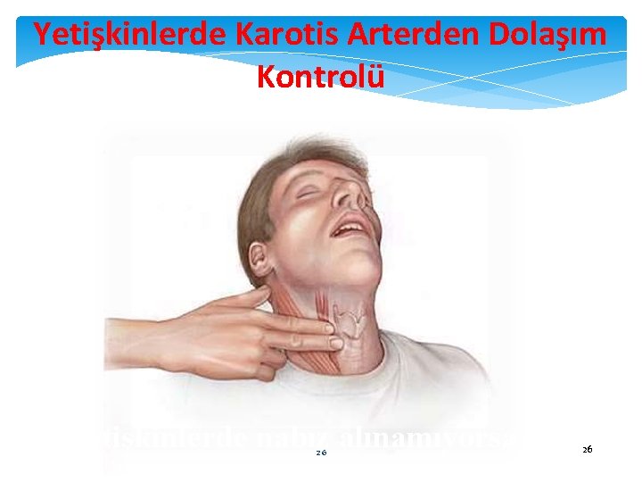 Yetişkinlerde Karotis Arterden Dolaşım Kontrolü Yetişkinlerde nabız alınamıyorsa 26 26 