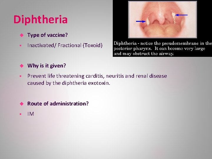 Diphtheria Type of vaccine? § Inactivated/ Fractional (Toxoid) Why is it given? § Prevent