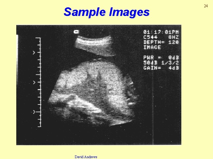 Sample Images David Andrews 24 