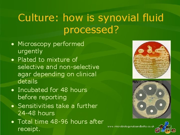 Culture: how is synovial fluid processed? • Microscopy performed urgently • Plated to mixture