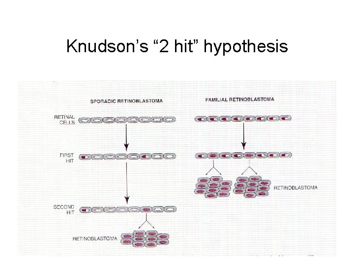 Knudson’s “ 2 hit” hypothesis 