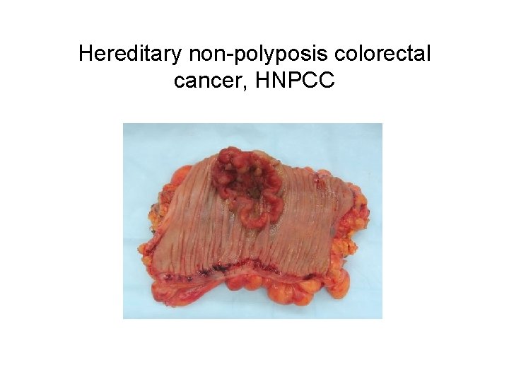 Hereditary non-polyposis colorectal cancer, HNPCC 